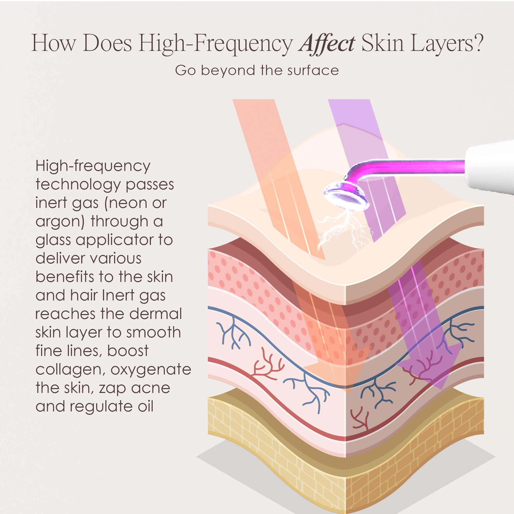 Faisca Neon & Argon high frequency wand showing skin infographic on how high frequency treatment affects the skin’s layers